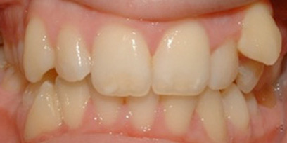 Before & Afters