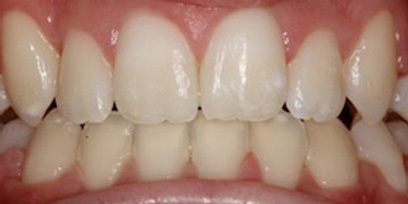 Before & Afters
