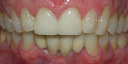Before & Afters
