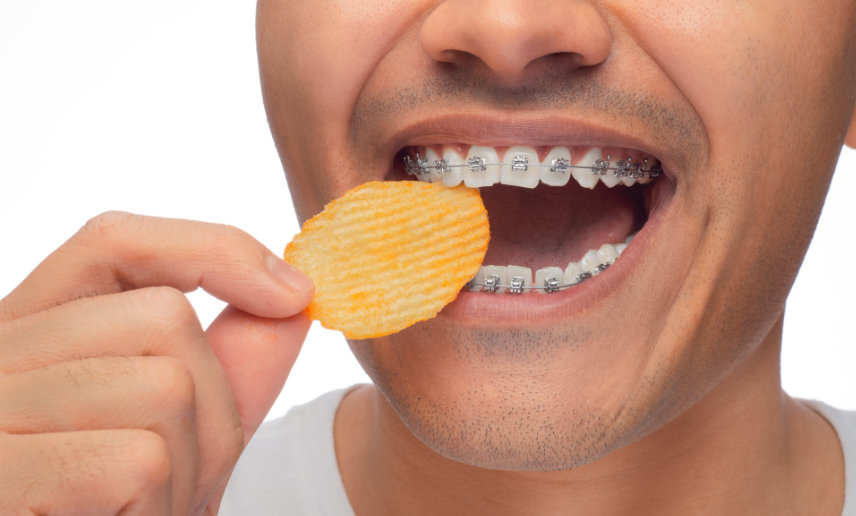 What Can I Eat With Braces? Your Guide to Enjoying Food During Treatment