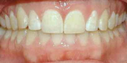 Before & Afters