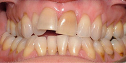 Before & Afters