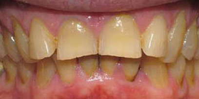 Before & Afters