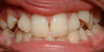 Before & Afters