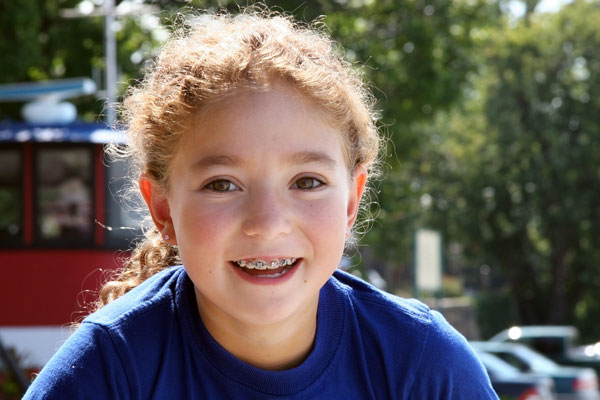 When Is the Best Time for Kids to Get Braces?