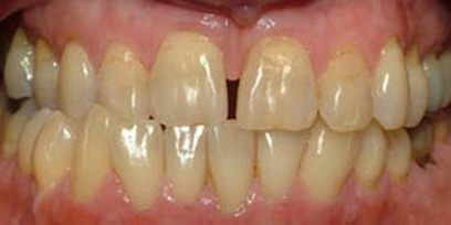 Before & Afters
