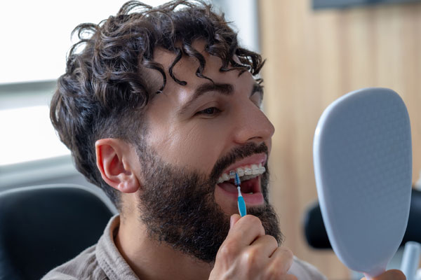 Do Ceramic Braces Stain? A Practical Guide From Knox City Orthodontics