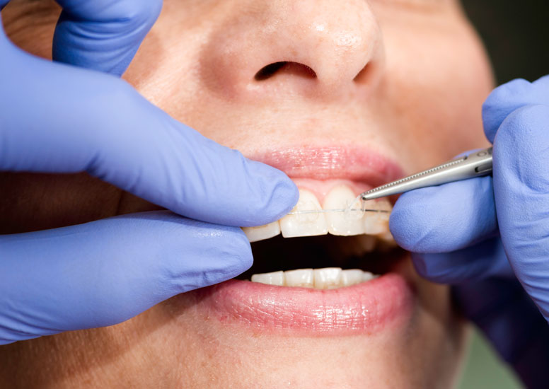 Orthodontic emergencies:
what to do and when to call