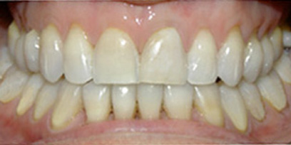 Before & Afters