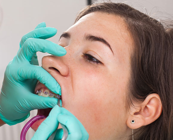 Orthodontic emergencies Orthodontic emergencies